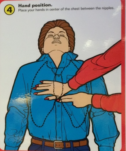 In the event of David Hasslehoff having a cardiac arrest this is the correct procedure to use….