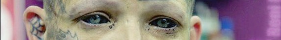 psychobat-art:  Corneal tattoos, also known as eyeball tattoos.