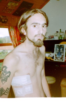 found this old photo from after my operation&hellip;. Can`t believe I was that skinny! 1999