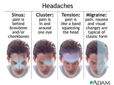 peashooter85:As someone who suffers from cluster headaches and migraines, I like this graphic. Good 