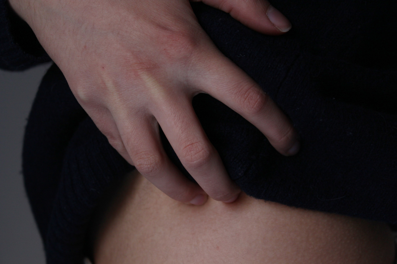 katieleesangphotography:Skin  Canon 500D