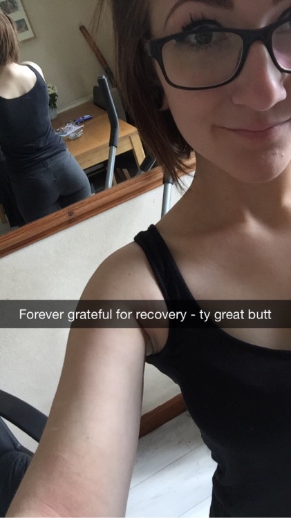 kinkkittxn:  So thankful I’ve recovered from my ed, like there would be nothing to spank if I hadn't