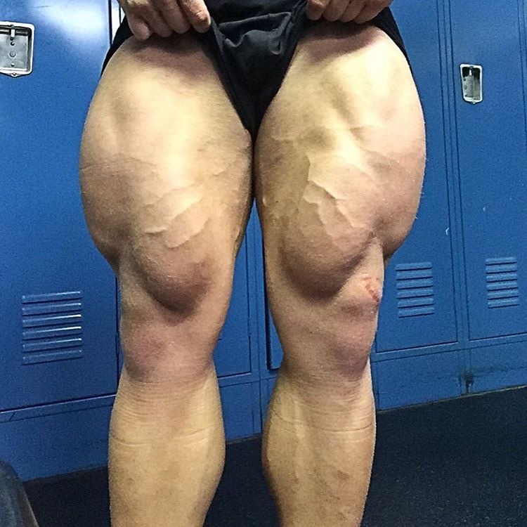 Brandon Beckrich