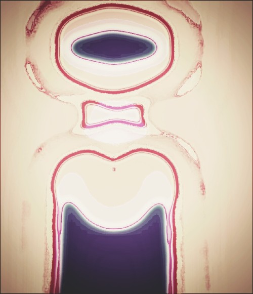 Hello Mr.Burdened