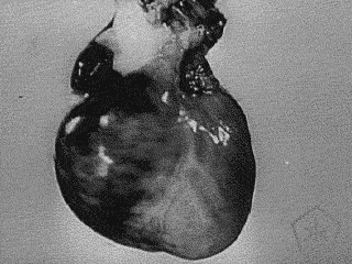 okkultmotionpictures: Listen To Your HeartOut-of-copyright medical science GIFs Source: