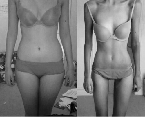 xskinnymilkx:  guns-inmy-head:  desireforskinny:  Favorite thinspo: before and after edition  I love this 