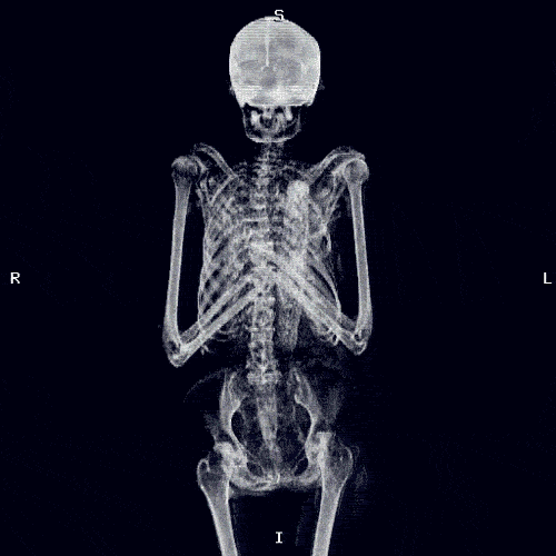 contortioncrazy:Just another gothic gif 