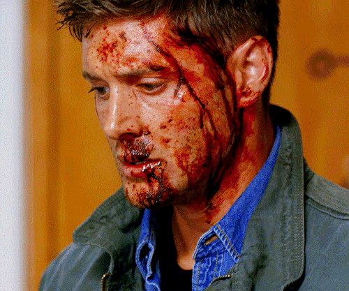 JENSEN ACKLES As DEAN WINCHESTER Supernatural | I Think I'm Gonna Like It Here (9.01)