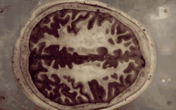 marabao:  medicalschool:  The human brain