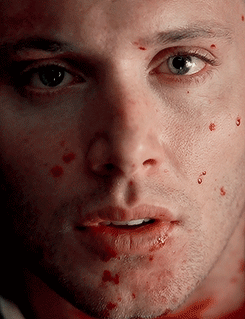 dustydreamsanddirtyscars: #DEAN APPRECIATION WEEKSUNDAY: A Set Dedicated to Dean // Bruised, Bloody and Still Utterly Beautiful
