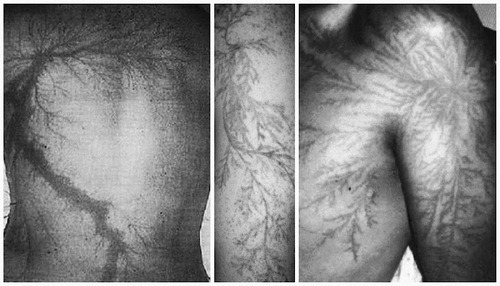 schizoidgenius:  Lightning flowers