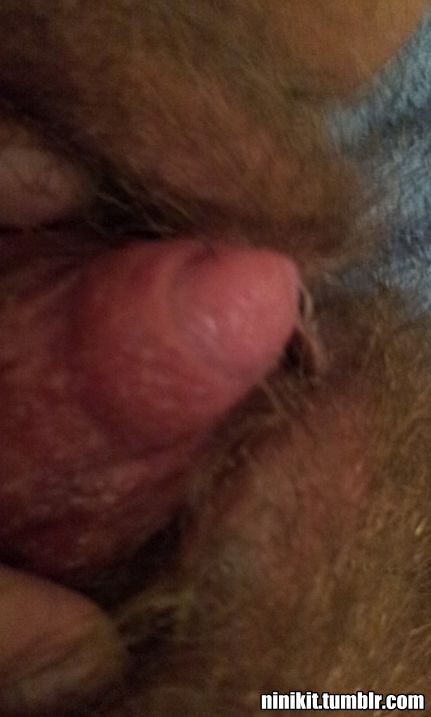 And finally, part 3 of my clit pump set.