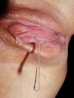 vulvahub:  Dripping  Always reblog wet pussy