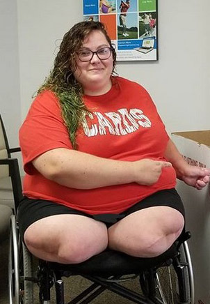 Very plump DAK bulging from the sides of her wheelchair
