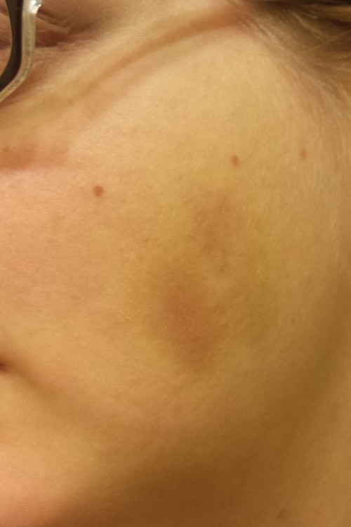 Daily Picture Assignment #8 [2.15.2015] A face mark Reaction Junkie gave me earlier this year. It&rs