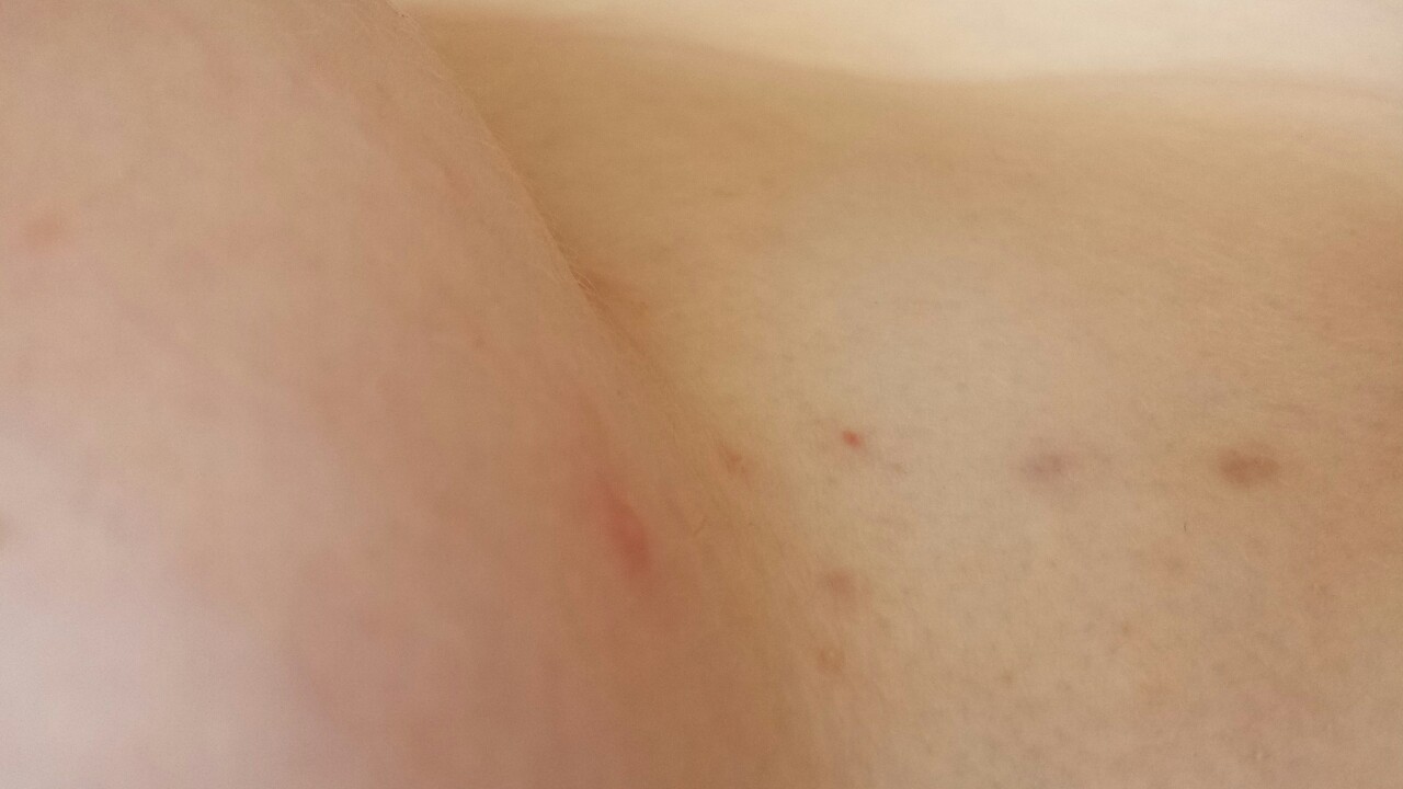 daddyismymrj:  Bits of me I need to learn to love: -My scars. -Stretch marks. -My