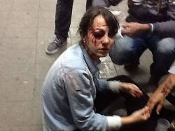 feridosnoprotestosp:  Giuliana Vallone, repórter da Folha, foi atingida por um disparo de bala de borracha da tropa de choque da Polícia Militar (foto: Diego Zanchetta/Estadão Conteúdo) (x) 