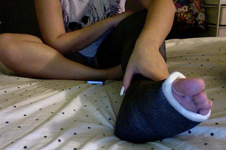 alexia17fan: long black leg cast and white painted nails!! in a cast for 8 weeks….so Humbling