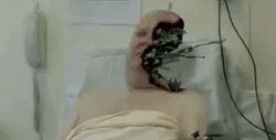sixpenceee:  Metalosis Maligna is a fake disease invented by award-winning Dutch