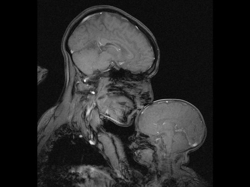 Neuroscientist captures an MRI of a mother and childProfessor Rebecca Saxe (MIT) has taken the first