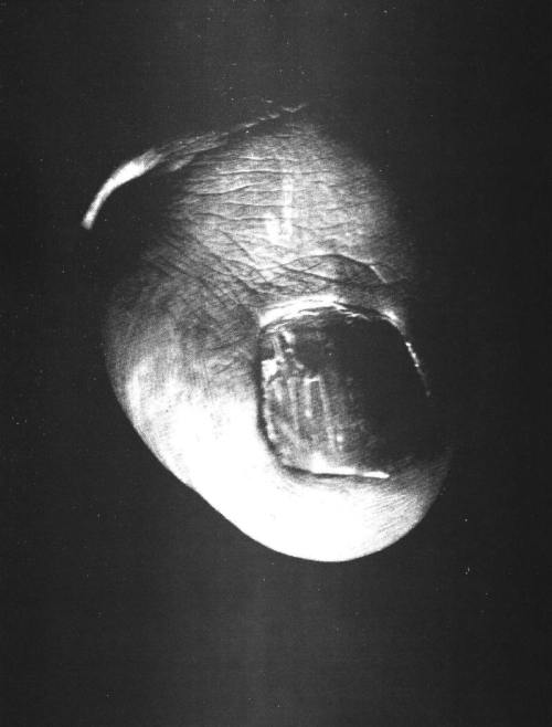 magictransistor:  Jacques-André Boiffard. Photomontage, Renée Jacobi, Masque de Carnaval, Gros Orteil, Masque de Carnaval, Sans Titre, Sous le Masque Pierre Prèvert, Firearm, Morphine and Strychnine Bulbs, Bouche, Sans Titre. 1929-1933. 