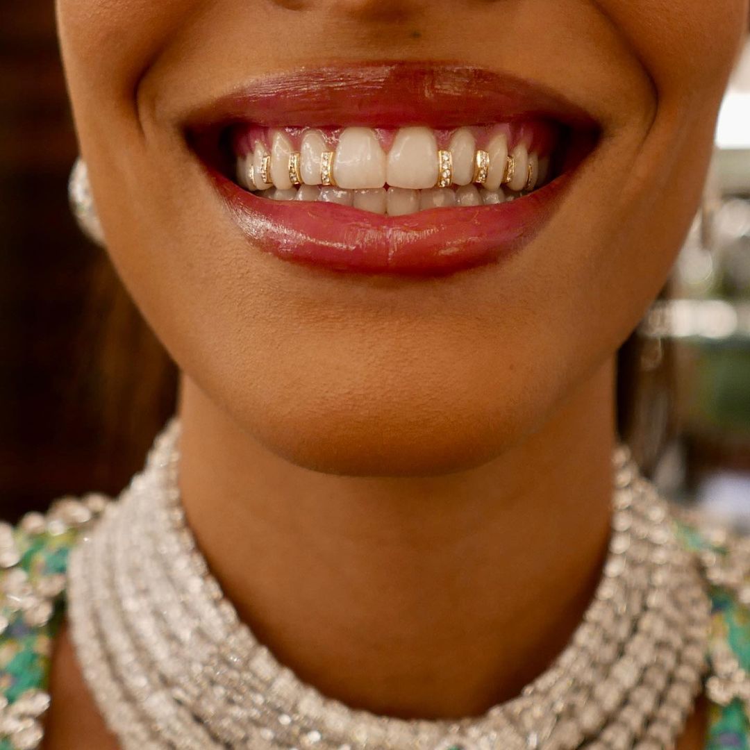 VIDEO. Un bijou «grillz» comme Rihanna, made in Paris - Le Parisien