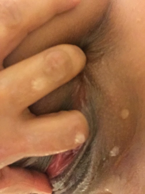 https://wakefield17.tumblr.com/post/154806638583