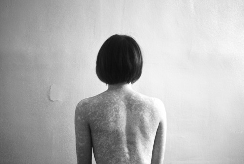 Scars © https://www.instagram.com/yorgos.kotsakis/ #lyon#france#europe#girl#naked#wall#back#scars#hair#bob#cut#carre#break #Black and White #shoulders#art#contemporary#photography#lines#contrast