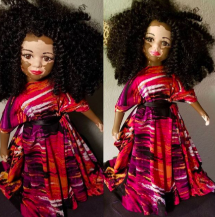 micdotcom:  An artist in Missouri is creating dolls with vitiligo and albinism to celebrate diverse beautyWhile the fashion industry is slowly opening up to models with various skin conditions — models such as Winnie Harlow, who has vitiligo, and Shaun