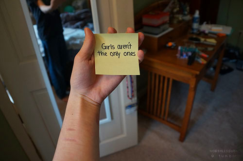 h4rrry:  worthlesswbu:  Every time I have uploaded a picture where my scars were