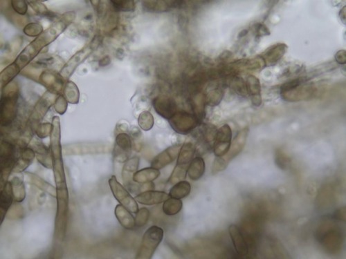 The sooty moulds (fungi) collected and observed from different hosts (Trochetiopsis x benjaminii, So