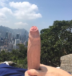 Foreskin Anonymous