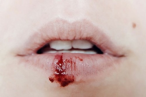 una-decepcion-mas:  x
