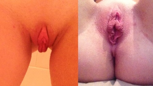 fishin75:  swimrunfish:  vaginasoftheworld:  Im 19, this is my vagina. I have always been self conscious about it. When I have sex I always hold back because I’m embarrassed of it. I have considered getting a Labiaplasty so I can finally have more