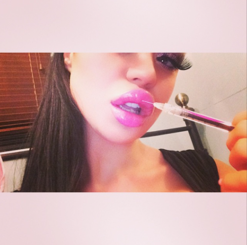 mistydoll: darkersideofthestone: The New Average Ok 2 things.Is she injecting her own lips?Is that a