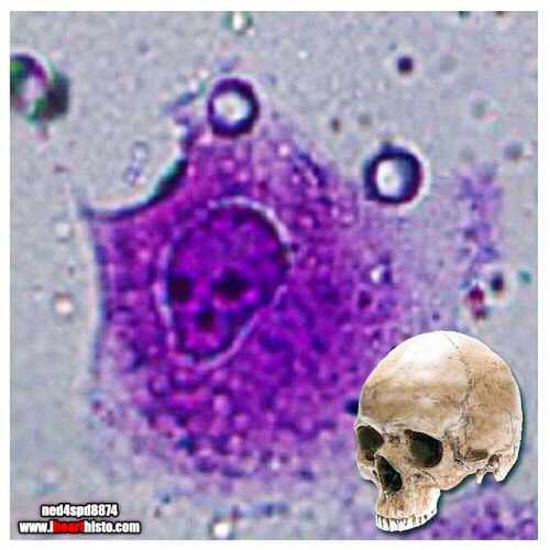  The Creepiest Fibroblast You Will Ever See With a nucleus straight from the fiery depths of hell*ih