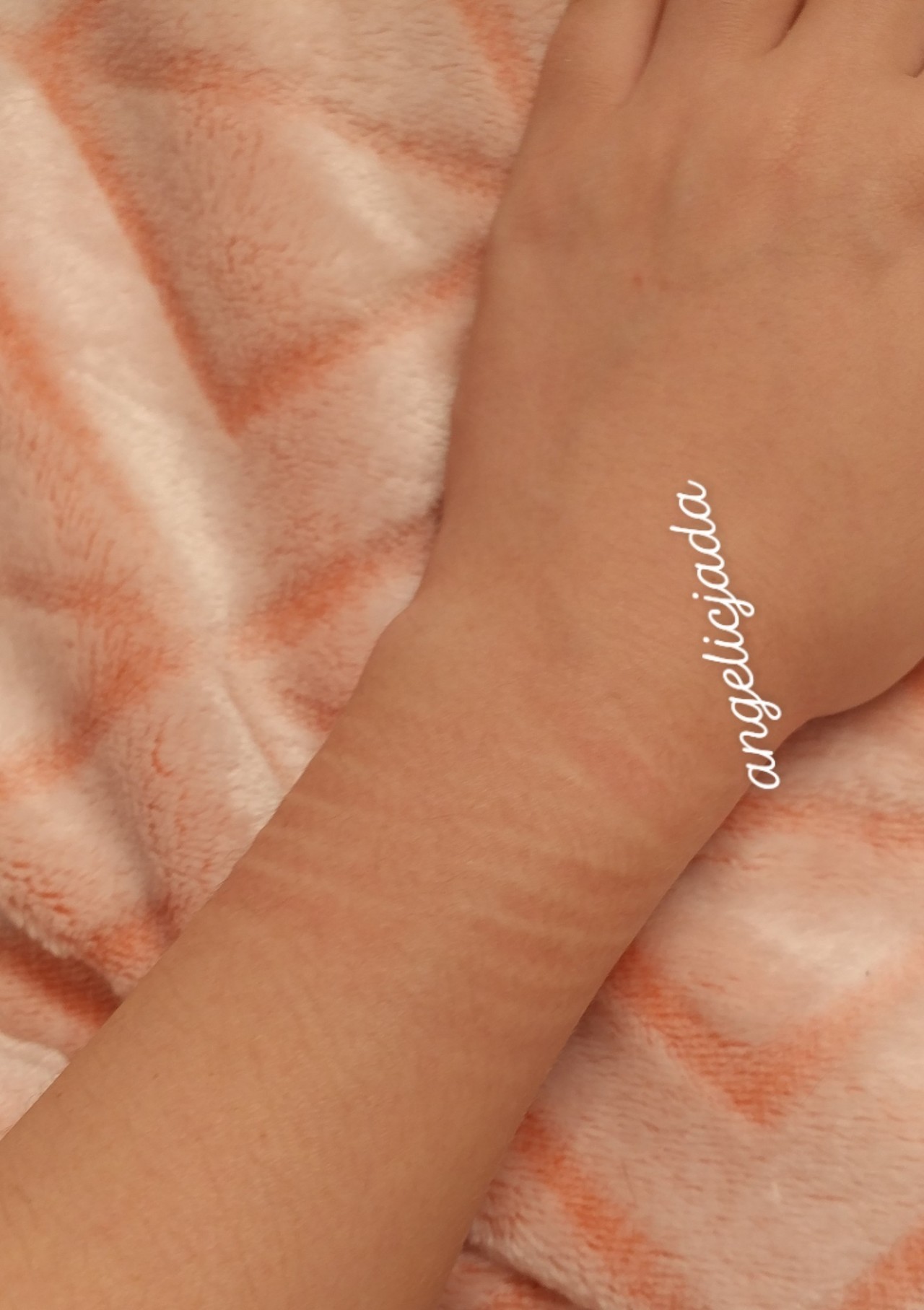 tea-cuts-and-bruises:  tea-cuts-and-bruises: Post Bondage Shoot Vibes 🎀⛓   IG: