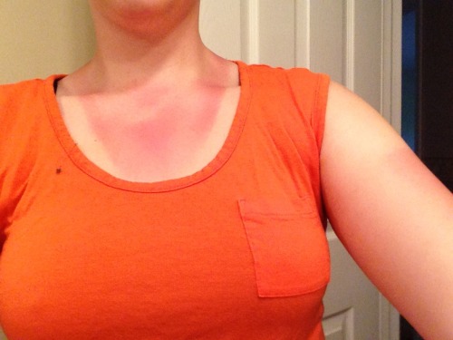 dontcallhernymphadora: First day of band camp. Yay, neck strap tan line is back.