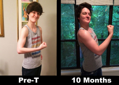 Been a while since I updated! As such I decided to add my new 10 month progress pictures and also so