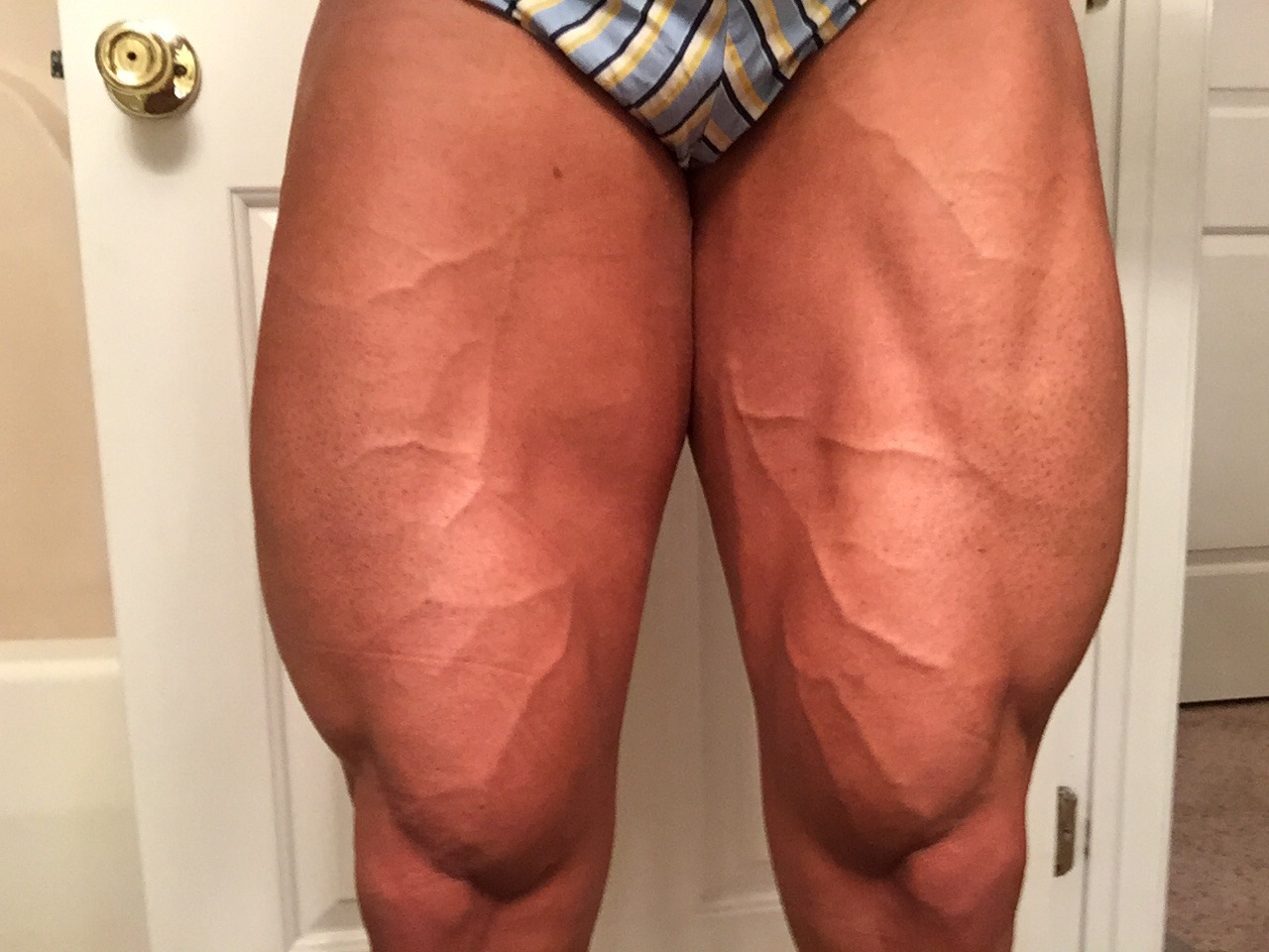 My legs 2 mornings after show