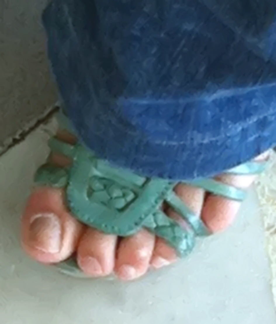 fan-feet:  #Toes and #Arch