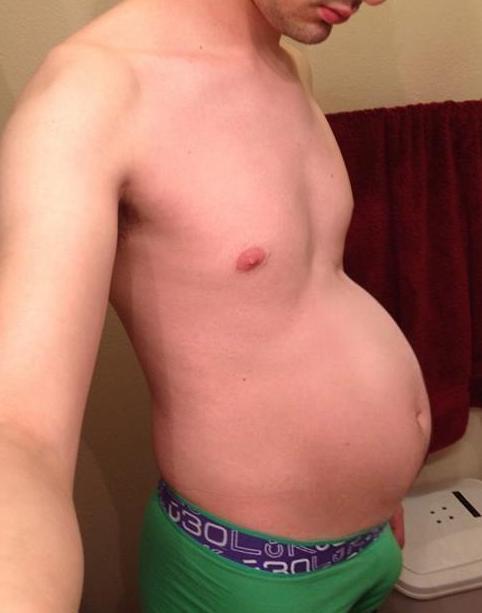 blogartus:  Slender body, freakish inflation of the belly.