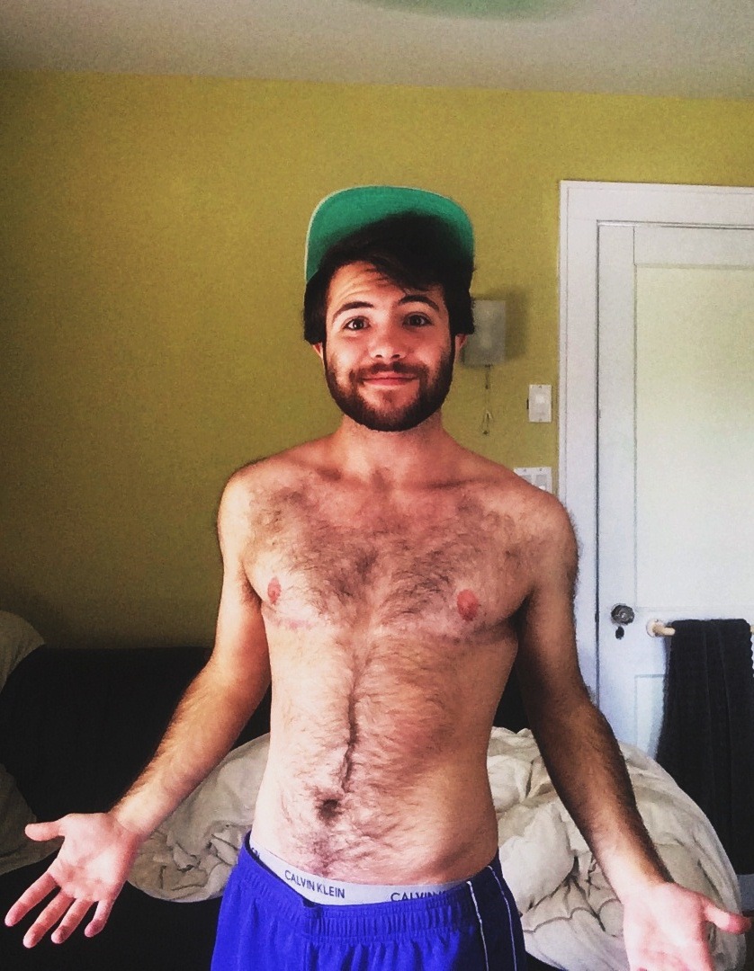 livingintranslation:  Holy shit next week I will be 1 year post op!2.5 years on T,