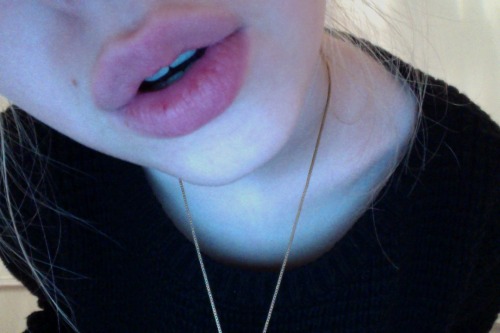 lunnasphere:  you can hardly see my braces here ooo