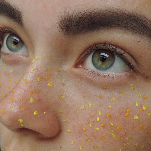 wanderixg: Blue freckles 30 weeks ago and yellow today - how much I’ve changed