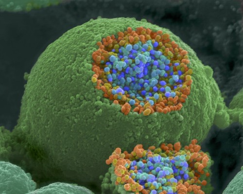 frontal-cortex: Scanning electron microscope picture of a nerve ending that has been broken open to 