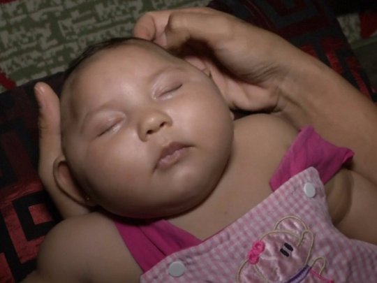 XXX Zika Virus Could Infect 'Thousands' of Pregnant photo