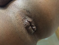 bigblackholelove:  arabboycunt:  A story of fucked up hole .  Dark arab hole looks good.