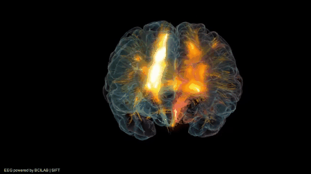 Visualización del proceso neuronal en el cerebro... - Cerebro Digital
