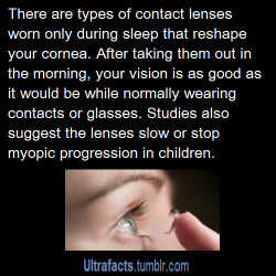 vancity604778kid:cneda105:ultrafacts:Source For more facts follow Ultrafacts  I HAVE THESE!  Dream lenses!